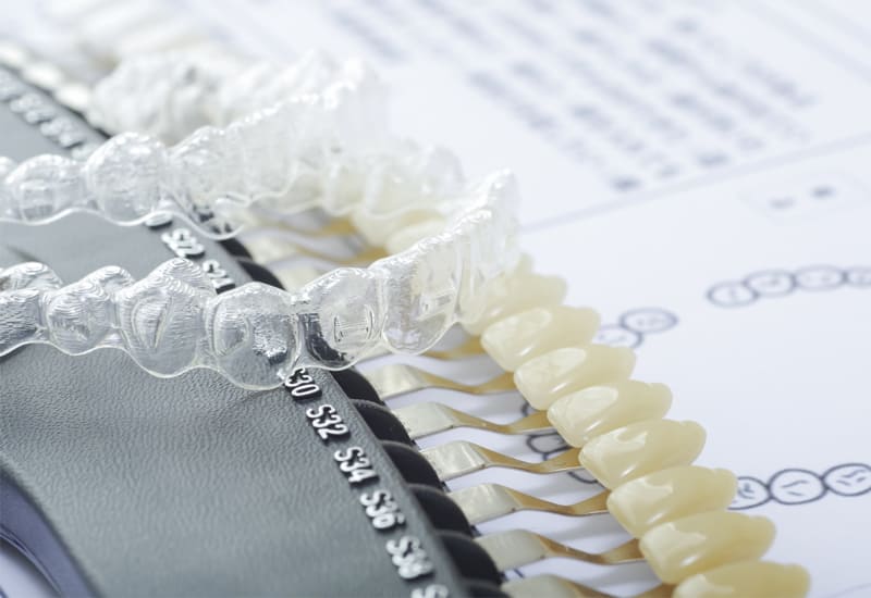 ホワイトニング